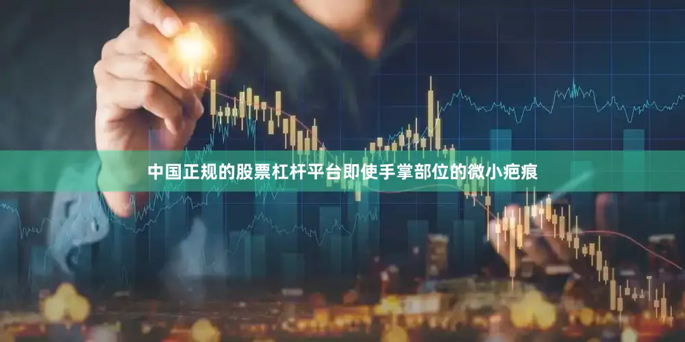 中国正规的股票杠杆平台即使手掌部位的微小疤痕